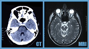 CT & MRI scans