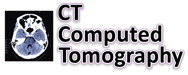 CT Computed Tomography scan