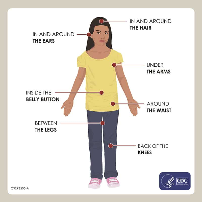 Areas of the body to check for ticks.